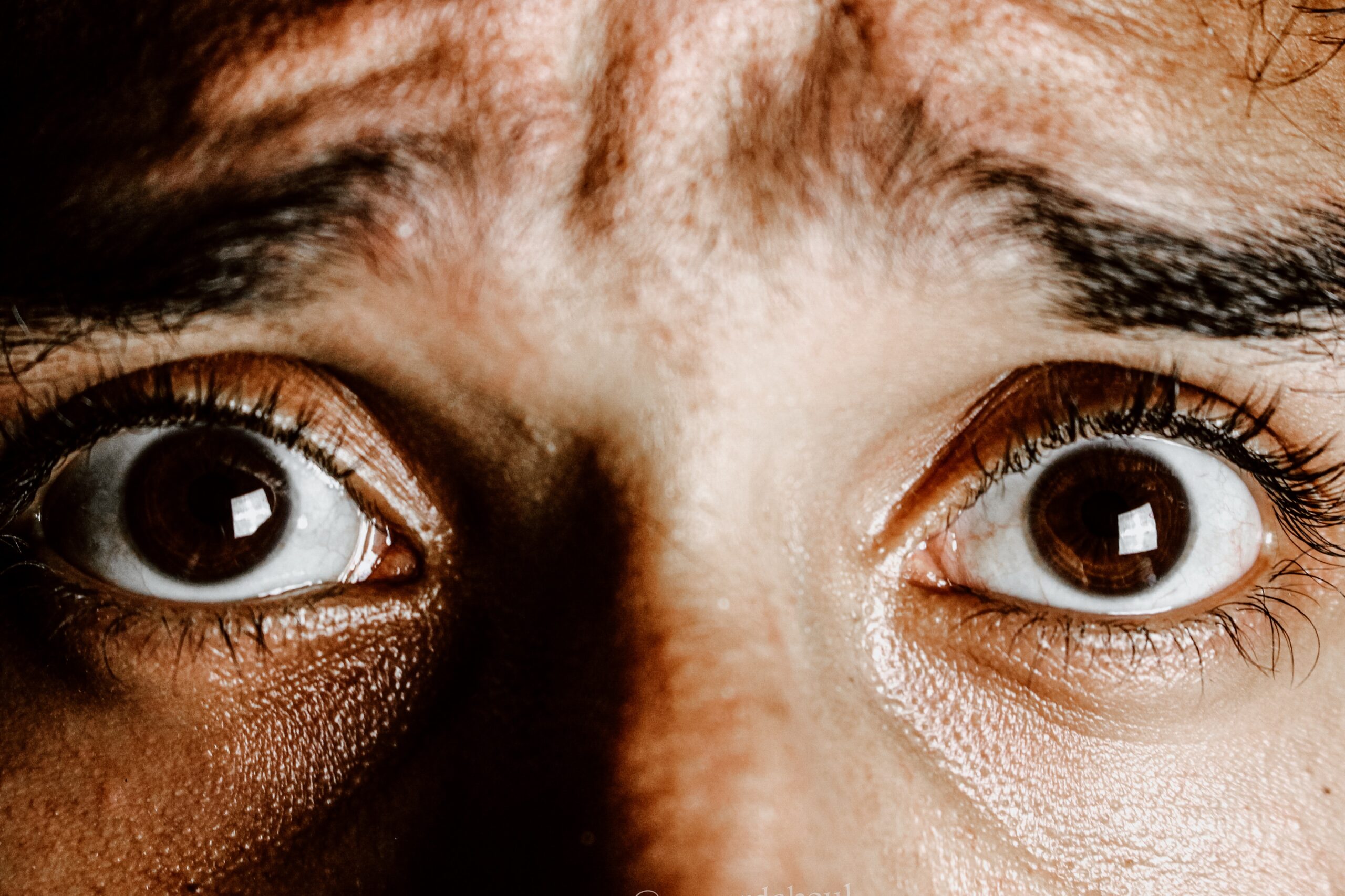 Close p of a man's worried looking eyes.